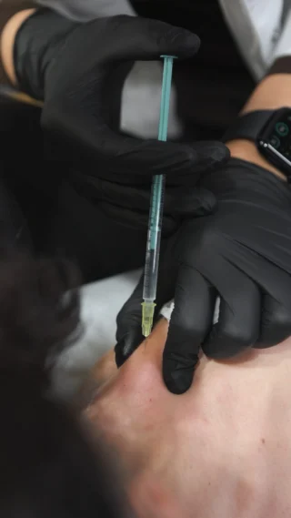 Es gibt minimalinvasive Behandlungen, die nicht nur unser Aussehen verbessern, sondern gleichzeitig unserer Gesundheit zugutekommen.❤️

Wir verbringen viel Zeit im Sitzen und sind ständigem Stress ausgesetzt – das wirkt sich negativ auf unsere Muskulatur aus und äußert sich vor allem in Verspannungen im Schulterbereich. Die Folge: Kopfschmerzen, Spannungsschmerzen sowie eine eingeschränkte Schlaf- und Lebensqualität.🥲

👩🏻‍⚕️Die gute Nachricht: Mithilfe von B-tox können wir diese Verspannungen deutlich lindern – in manchen Fällen sogar vollständig auflösen. Ein schöner Nebeneffekt ist, dass der Schulter- und Halsbereich dadurch optisch schmaler und femininer wirkt.✨

📲 Du bist an so einer Behandlung interessiert? Dann vereinbare Deinen Termin unter dem Link in der Profilbeschreibung.

Wir freuen und auf Dich!❤️