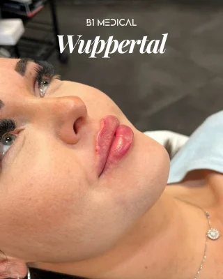 👨🏽‍⚕️Es ist unglaublich, was für wunderschöne Lippen unser leitender Arzt Murad an unserem Standort in Wuppertal zaubern kann – absolut feminine und sinnliche Form, ein flaches Seitenprofil und eine definierte Lippenkontur… 💉👄
 
➡️ Bei B1 Medical bieten wir Dir jedoch nicht nur wunderschöne Ergebnisse, sondern auch:

✔️ Erfahrene Ärztinnen und Ärzte; ✔️ Hochwertige Produkte; ✔️ Eine Exklusivpartnerschaft mit Juvéderm; ✔️ Ein top Preis-Leistungs-Verhältnis; ✔️ Zeitnahe Termine; ✔️ Standorte in bester Lage.

Also, worauf wartest Du noch?🧡💜

📲 Vereinbare jetzt Deinen Termin über den Link in unserer Profilbeschreibung.

Wir freuen uns auf Dich!